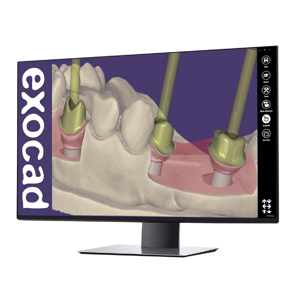 Exocad Software: Implant Package — Flex Subscription